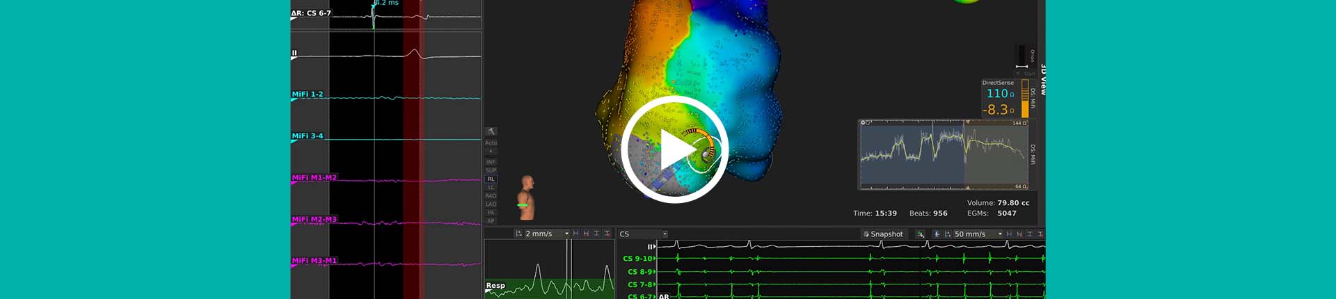 Instituto arritmias cardiacas