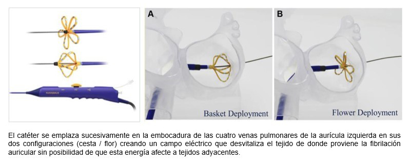 Fibrilación auricular PFA