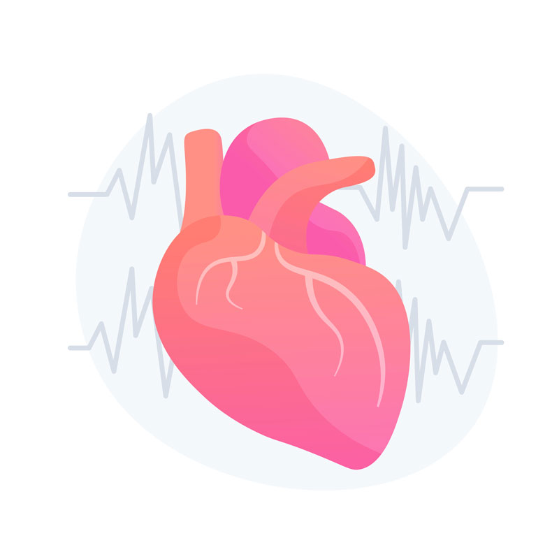 Ablación de taquicardia supraventricular