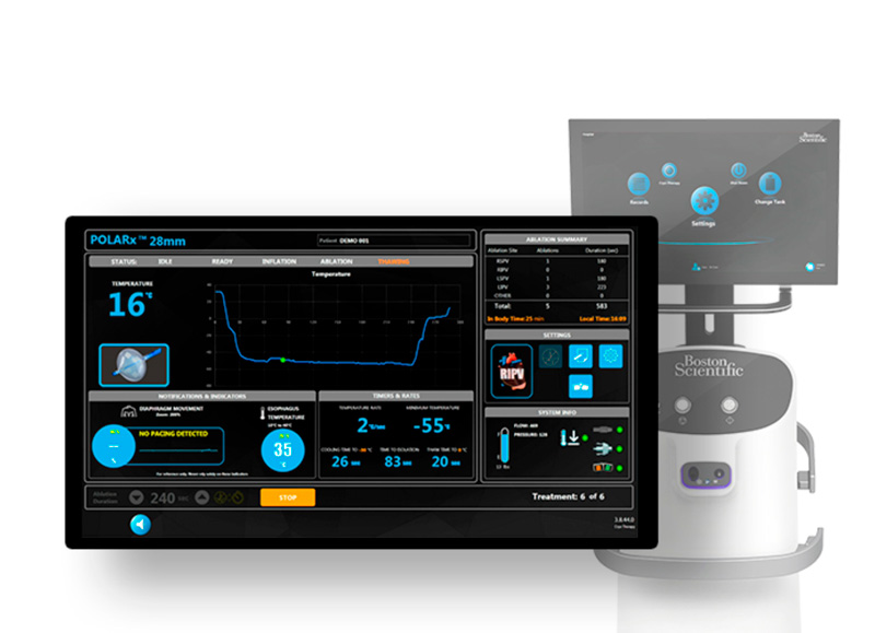 Sistema De Crioablación Con Balon Polarx