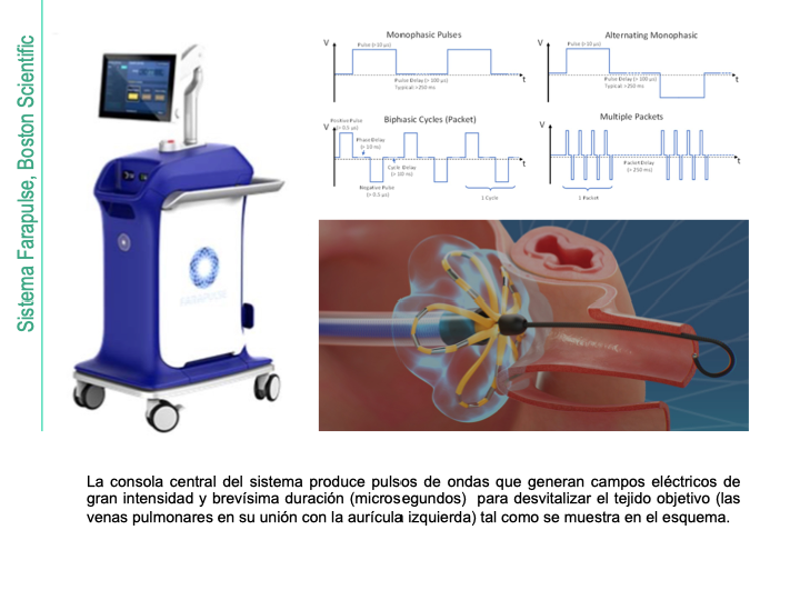 Tecnología y medios instituto de arritmias
