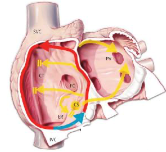 Causas y tratamiento del Flutter auricular